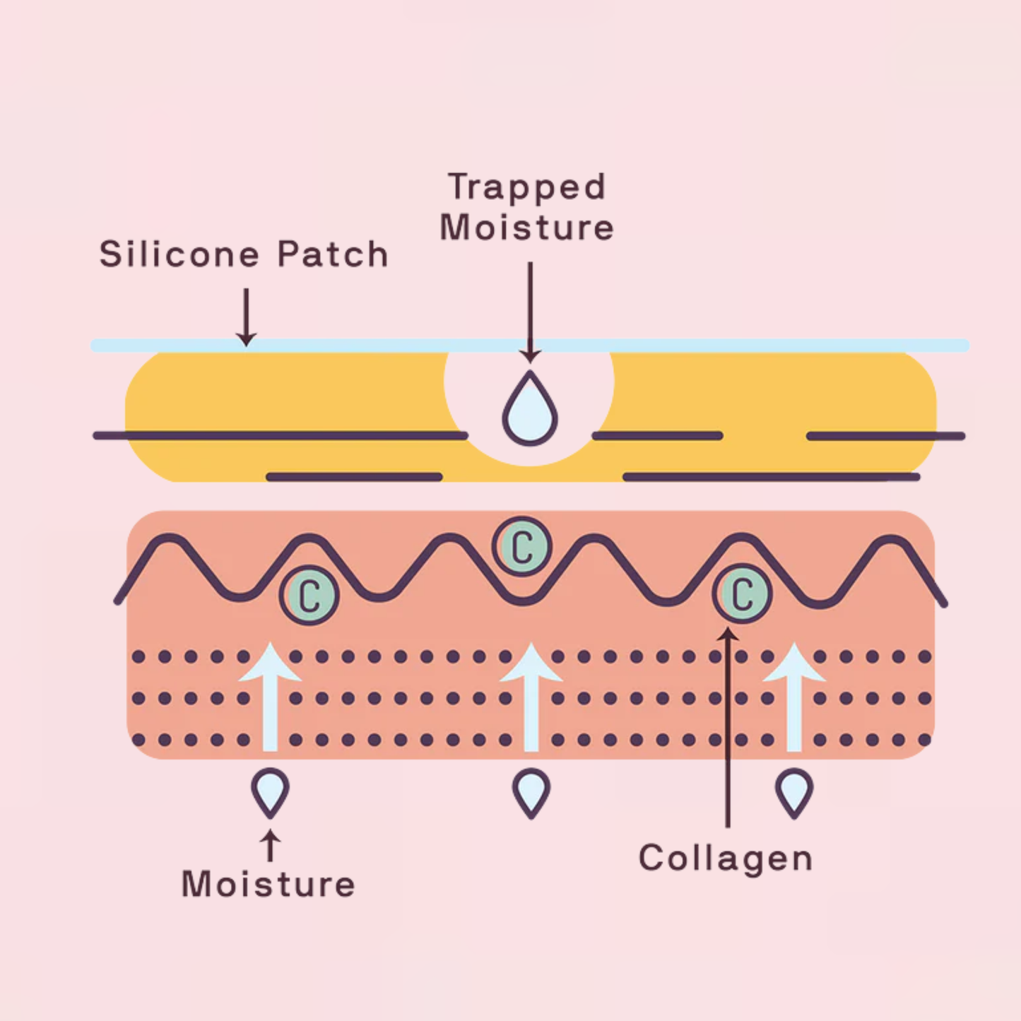 Silicone StretchMark Prevention Pack™