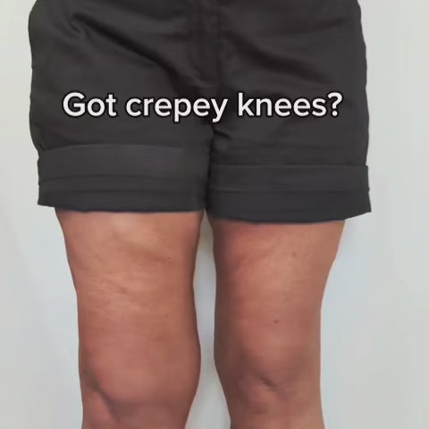 Materna: The Cellu-Smooth Patch™